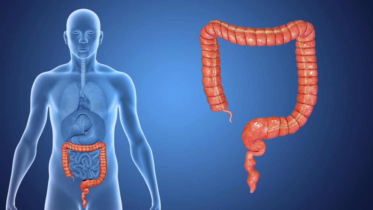 Colorectal Cancer: A Comprehensive Guide to Awareness and Prevention